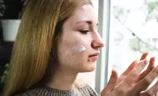 Common Acne Drug Can Become Carcinogenic at Room Temperature, Say Doctors; Know How