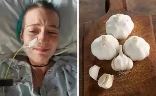 Vampire Disease: Woman Suffers Agonizing Pain, Migraines After Eating Garlic; Know All About This Rare Metabolic Disorder