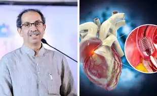 Will Uddhav Thackeray Undergo Angioplasty In Mumbai? All About This Artery Blockage-Clearing Procedure