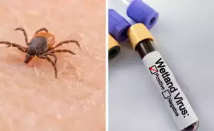 China Uncovers A Mysterious Tick Disease Which Causes Multiple Organ Dysfunction; How To Protect Yourself?