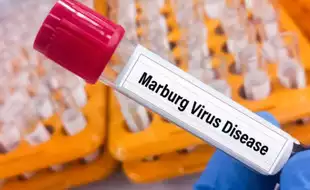 Rwanda Reports No Community Transmission Of Marburg Virus, Zero New Cases Recorded