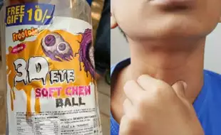 4-year-old Dies After Candy Sticks In His Throat Making Him Breathless; How Can You Reduce Choking Hazards In Children?