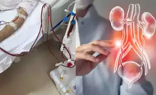 Men And Women On Kidney Dialysis Face Unique Heart Risks: Study