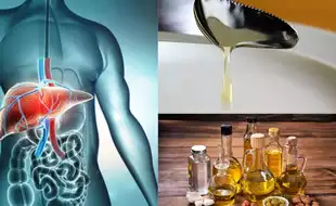 The Most Dangerous Food For Your Liver IS NOT Saturated Fat; Doctor Reveals The Real Risk