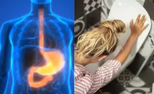 Woman Diagnosed With A Rare Swallowing Condition Must Stand Up While Eating Or Risk Choking To Death; Know All About Achalasia