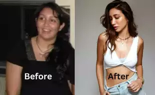 I Told Myself I’ll Never Give Up: Shreya Chaudhry Opens Up On Losing 30 kg After She Put On Weight Due To Slip Disc at 19